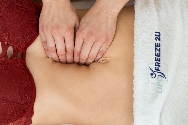 diastasis recti treatment Brentwood