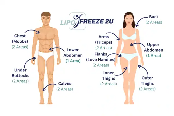 Areas you can have fat freezing treatment Brentwood