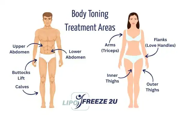 Graphic showing where you can have Body toning Treatment Brentwood on your body
