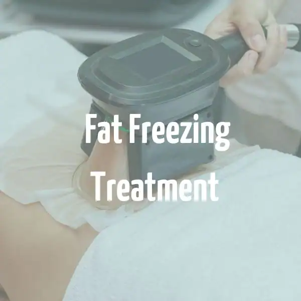 fat freezing treatment Brentwood